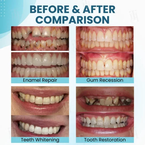 AEXZR® Makesmile Prášok na ústnu liečbu s včelím jedom